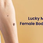 Lucky Mole on Female Body